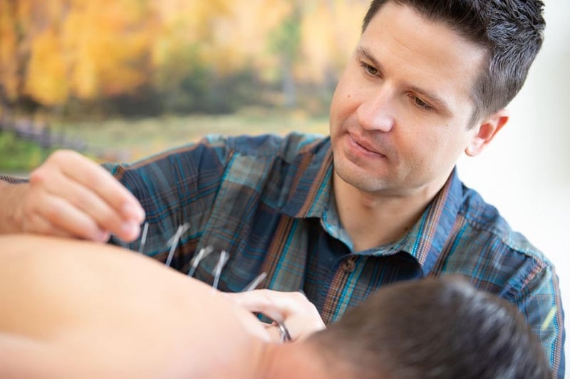 Acupuncture Image